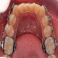 Orthodontics