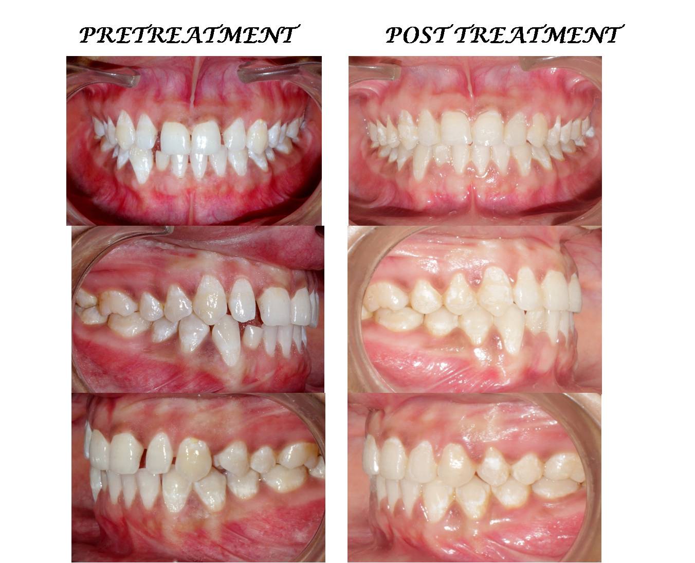 Orthodontic