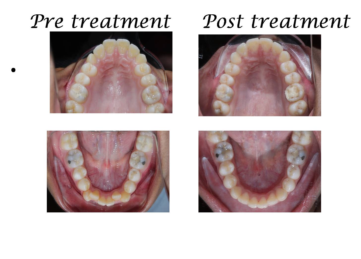 Orthodontic
