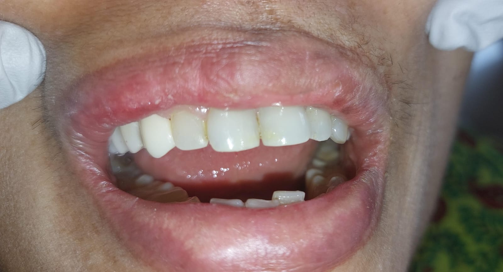 Before Image