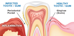 RCT -(After)