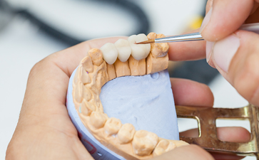 Crown preparation of tooth