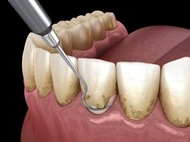 Periodontic 