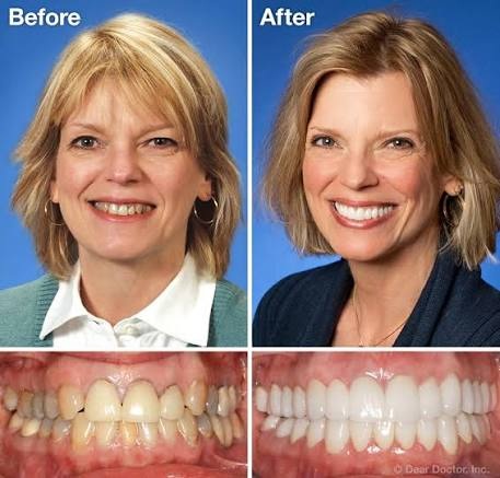 Cosmetic Dentistry -(After)