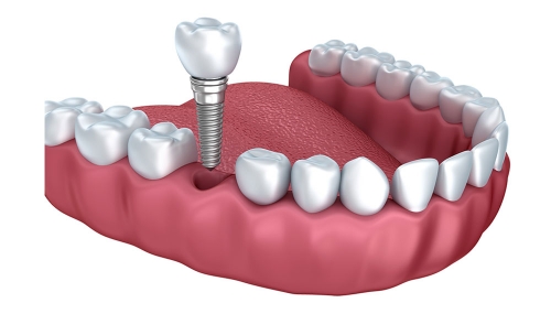 DENTAL