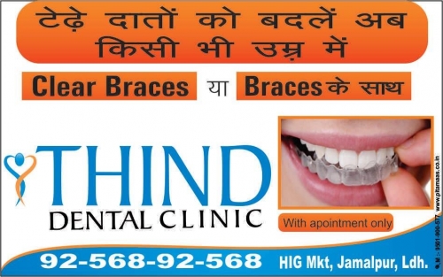 Dental Sealants