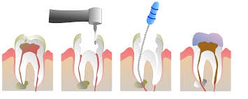 ORTHO TREATMENT