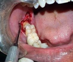 ORTHO TREATMENT