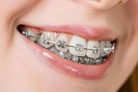 ORTHO TREATMENT
