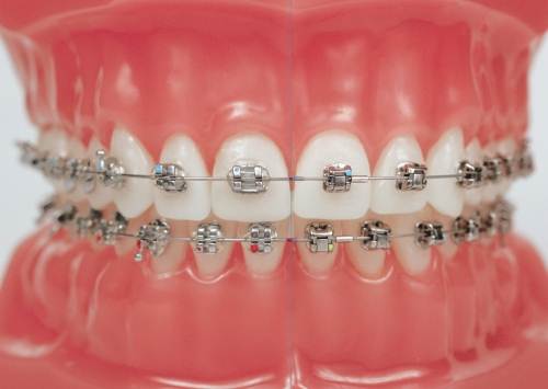 Dental Jewels
