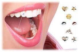 Dental Jewels