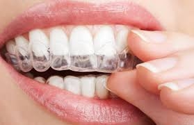 Root Canal Treatment