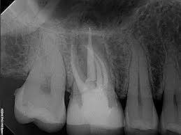 Dental Jewels