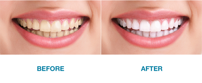 Thind Dental Clinic - Banner 1