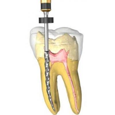 Cavity