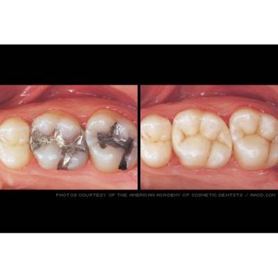 Cavity
