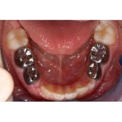 Cavity