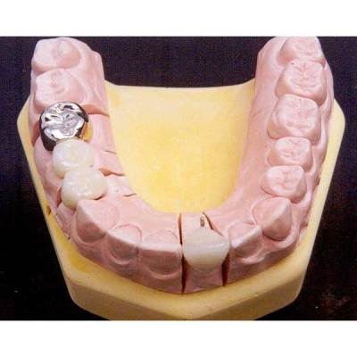 Cavity