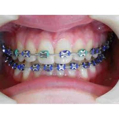 Cavity