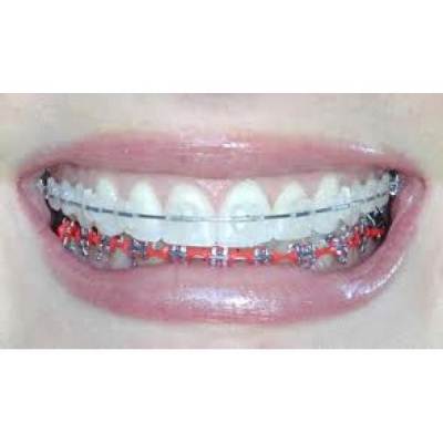 Cavity
