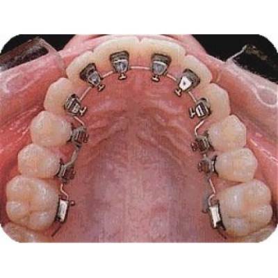 Cavity