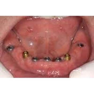 Cavity