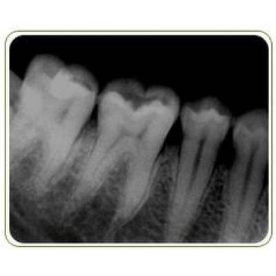 Cavity