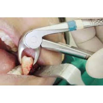 Cavity