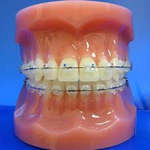 Cavity