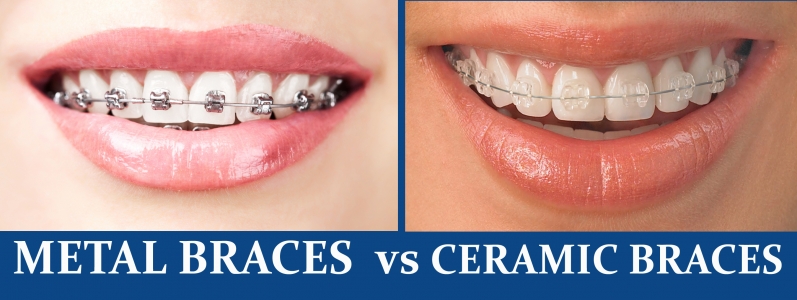 Srilaxmi's Smile Care Dental Clinic - Banner 2