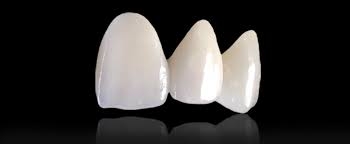 Ziconia Crowns